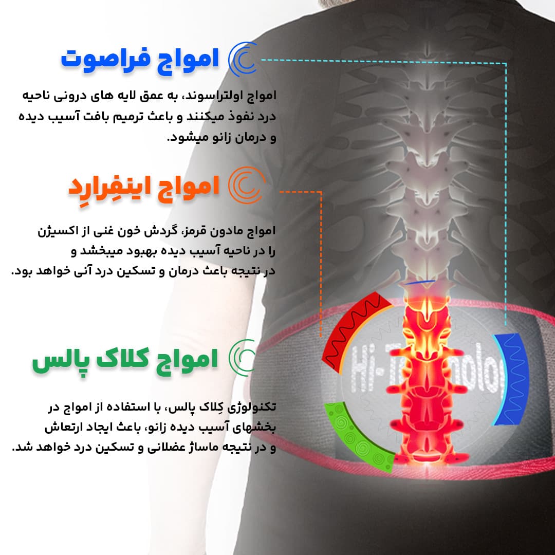 پلاتینر 